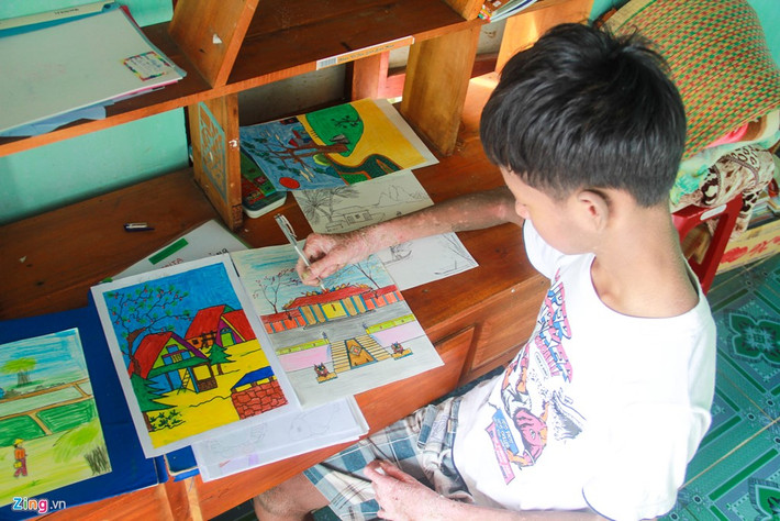 Năm 2014, trước sự phản đối của dư luận, lãnh đạo trường cho em nhập học. Ngay từ những năm học đầu tiên, Vương đạt thành tích xuất sắc. Đặc biệt về mỹ thuật, em luôn đứng đầu lớp.