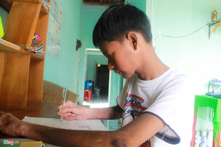 Dù đã 15 tuổi, Nguyễn Đình Vương mới học lớp 3 Trường tiểu học Trần Văn Ơn (xã Tam Anh Bắc). Ước mơ được đến trường của cậu bé tưởng đã bị dập tắt khi lãnh đạo trường này không cho em nhập học vì sợ người khác lây bệnh từ Vương.