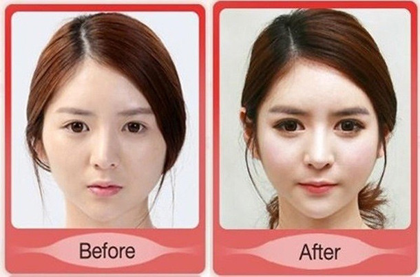 4. Bạn sẽ không còn giống như trước kia. Bạn đã bao giờ nghe câu nói: “Bạn không trân trọng những gì bạn có cho đến khi mất đi?”. Khi nhan sắc hay bất kỳ bộ phận nào của cơ thể được chỉnh sửa, lúc đầu sẽ tạo nên những cảm giác mãn nguyện nhưng chỉ kéo dài trong vài tháng.