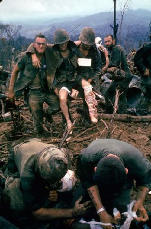 Lính Mỹ bị thương được băng bó, chữa trị tháng 10/1966. (Ảnh: Larry Burrows - Time & Life Pictures/Getty Images)