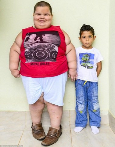 Misael Caldogno Abreu mắc chứng bệnh lạ khiến em không bao giờ hết đói và ăn không ngừng. Vì cân nặng quá nhiều nên đôi lúc khi ngủ, Misael ngừng thở. Cha mẹ em rất lo lắng vì sợ một ngày con trai mình sẽ không tỉnh dậy.