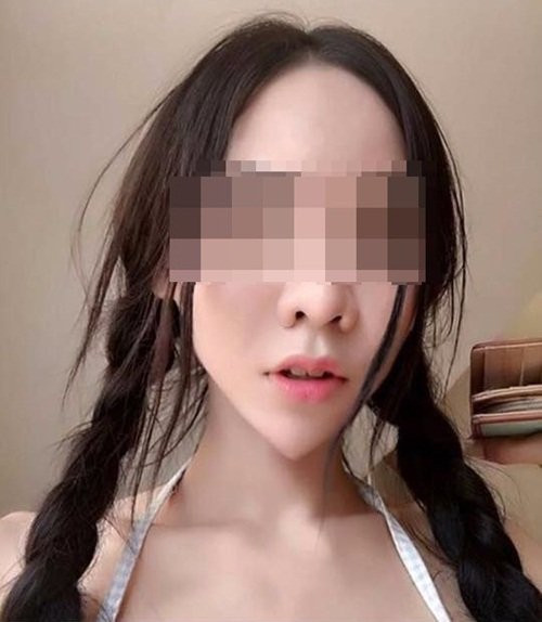 Sở hữu gương mặt V-line theo xu hướng thẩm mỹ hiện đại là điều nhiều cô gái trẻ mong muốn. Khuôn mặt V-line là khuôn mặt được tạo hình theo chữ V nhưng có độ mềm mại ở cằm. Đường cong mềm ở cằm giúp khuôn mặt trở nên thanh tú hơn, xinh đẹp hơn. Tuy vậy, một cô gái trẻ ở Thái Lan không bằng lòng với đường cong mềm mại đó, cô nàng muốn chiếc cằm của mình phải nhọt hoắt giống hệt chữ V. Hot girl mặt rắn quyết định phẫu thuật thẩm mỹ theo ý muốn.