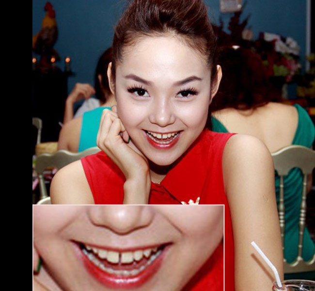 Minh Hằng rất xinh đẹp, nhưng khi cô cười lại để lộ hai chiếc răng cửa khá thưa khiến cô bị kém duyên.