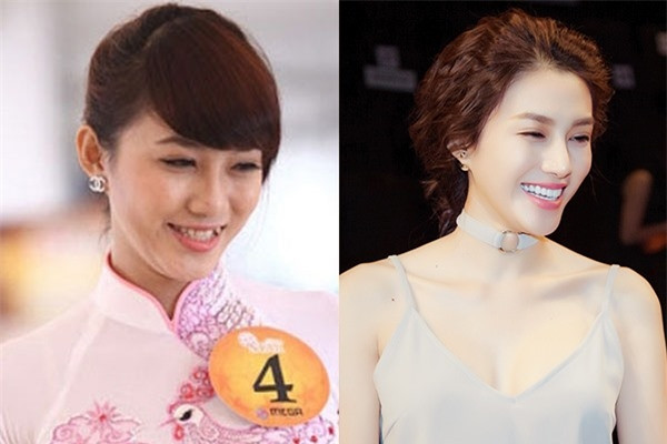 Nhìn hình ảnh trước đây của Lê Hà, nhiều khán giả cho rằng cô thật sáng suốt khi đi thẩm mỹ răng.