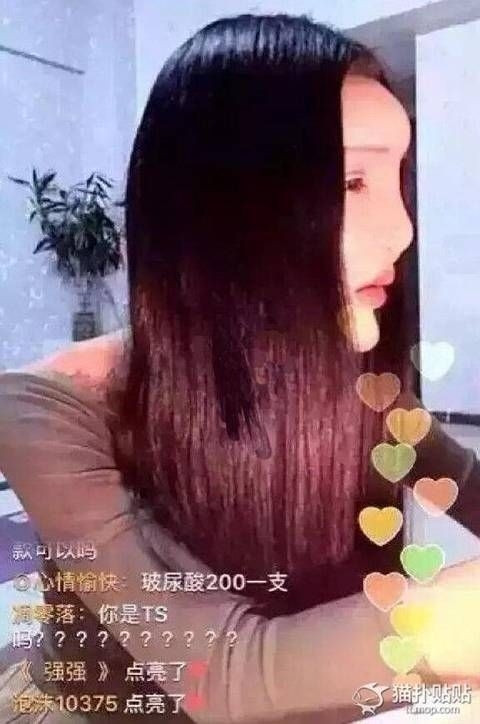 Gương mặt biến dạng khi nhìn ngang của cô gái.