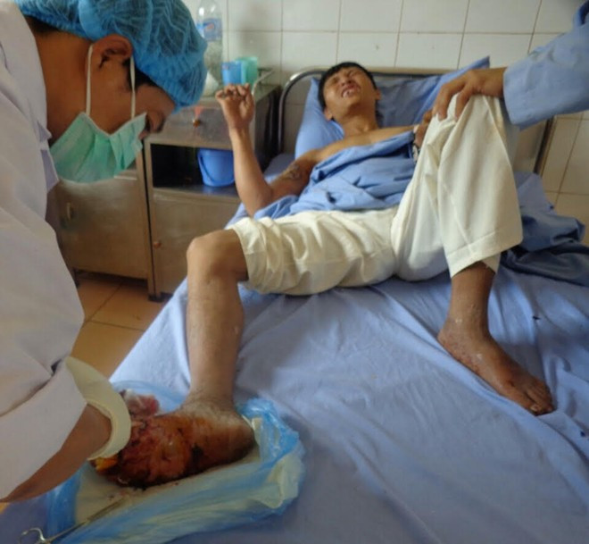 Có bệnh nhân sống những ngày cuối cùng trước khi ra đi, ánh mắt lúc nào cũng khát khao, đau đáu ngóng chờ người thân nhưng ngay cả khi nhắm mắt xuôi tay, vẫn không một ai đến bên cạnh", bác sĩ Hưng chia sẻ. Họ phải chịu sự đau đớn cả về thể xác lẫn tâm hồn. Ảnh: HH.