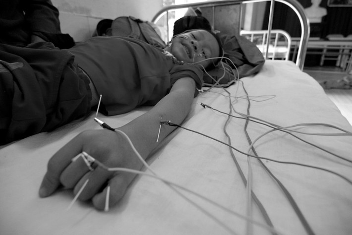 Bé Đạt đã 6 tuổi nhưng em không thể tự mình làm những việc sinh hoạt cá nhân bình thường. “Cháu tới trung tâm được một năm rồi, trước khi đến cháu không cử động được tay chân, bàn tay luôn co quắp và không biết nuốt nên mỗi lần cho ăn, tôi phải đánh vào mông cho cháu khóc gào mở miệng và để thức ăn tự trôi tuột vào họng. Nhìn con đau, con khóc, tôi xót lắm nhưng không còn cách nào khác để giữ mạng sống cho con”, khóe mắt người mẹ ấy bỗng cay cay.