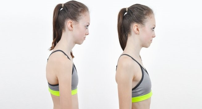 Áo ngực còn ảnh hưởng đến tư thế và vẻ ngoài của bạn. Một chiếc áo ngực không vừa có thể khiến lưng và vai của bạn bị còng.