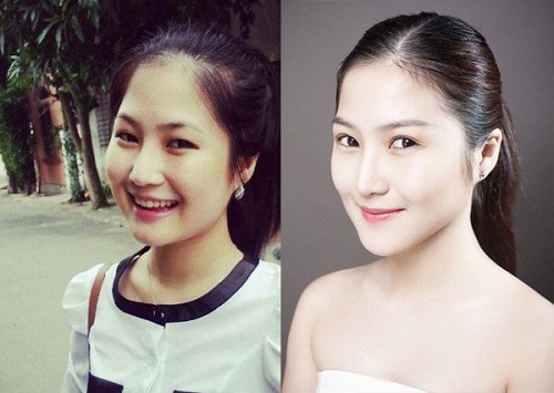 Ít lâu sau, cô đã có sự thay đổi chóng mặt về nhan sắc. Đầu mũi của giọng ca "Ngốc" đã nhỏ nhắn hơn, cùng với đó là cặp mắt hai mí rõ nét và chiếc cằm dài hơn.