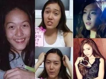 Mắt, cằm, xương quai hàm, hàm răng, trán là những chi tiết đã được chỉnh sửa trên khuôn mặt của một trong những " Đệ nhất mỹ nhân dao kéo" Jessica Jung.
