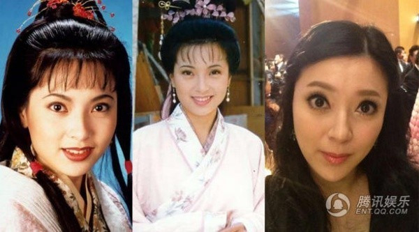 Nàng Quách Phù bản Thần điêu đại hiệp 1995 vì muốn trẻ mãi đã biến gương mặt mình thành… ma-nơ-canh lỗi. Phó Minh Hiến bị đánh giá thuộc top sao nữ nghiện tiêm botox. Khán giả tiếc nuối hình ảnh thời mới khởi nghiệp của cô.