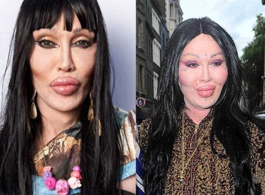 Amanda Lepore là một người mẫu kiêm ca sĩ chuyển giới có tiếng trong làng giải trí Mỹ. Bệnh nghiện phẫu thuật dường như đã phá nát thân hình, khuôn mặt khiến Amanda luôn xuất hiện trong danh sách "thảm họa dao kéo".