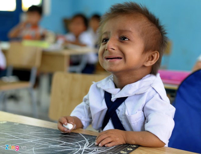 Bàn tay bé xíu cầm phấn, cậu bé chăm chú nghe cô giáo giảng bài. Cô Phạm Thị Ngói, giáo viên chủ nhiệm lớp 1B, Trường tiểu học Sơn Ba, thổ lộ nhiều năm về công tác giảng dạy ở trường, đây là lần đầu tiên dạy lớp 1 có cậu học trò đặc biệt như K'Rễ.