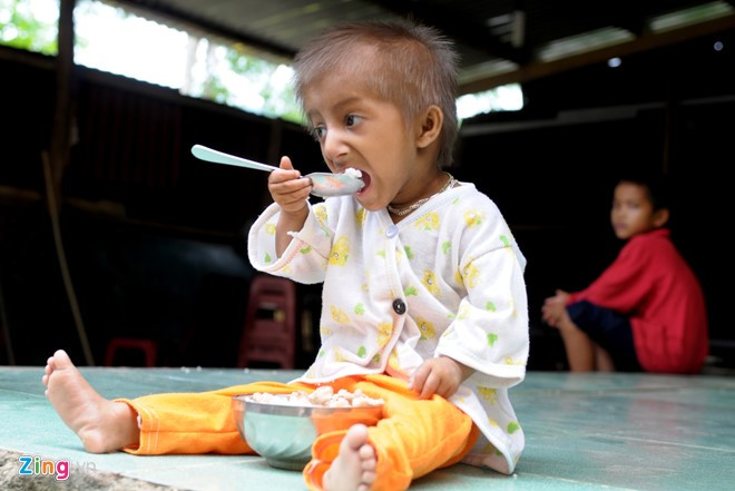 Sau vài tuần bỡ ngỡ, giờ đây, nam sinh có thể cầm muỗng tự xúc cơm trong chén.