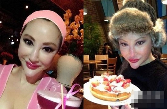 Nữ minh tinh gạo cội của điện ảnh Hong Kong Tiết Chỉ Luân khiến khán giả và người hâm mộ khóc thét khi nhìn thấy khuôn mặt ngày càng biến dạng vì gọt cằm, nâng mũi quá đà của cô.
