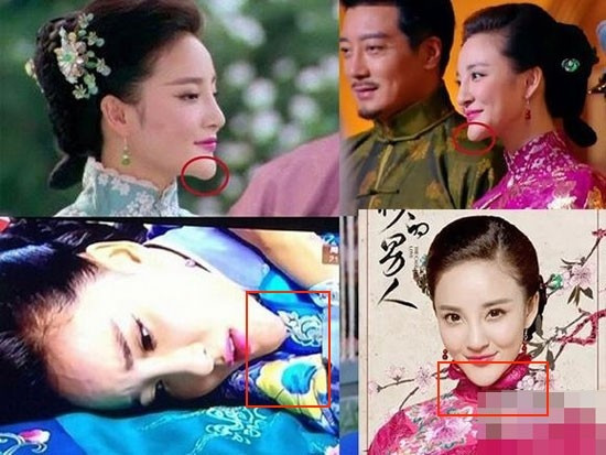 Chiếc cằm của Lưu Vũ Hân ngày càng dài và nhọn hoắt vì nhiều lần chỉnh sửa.
