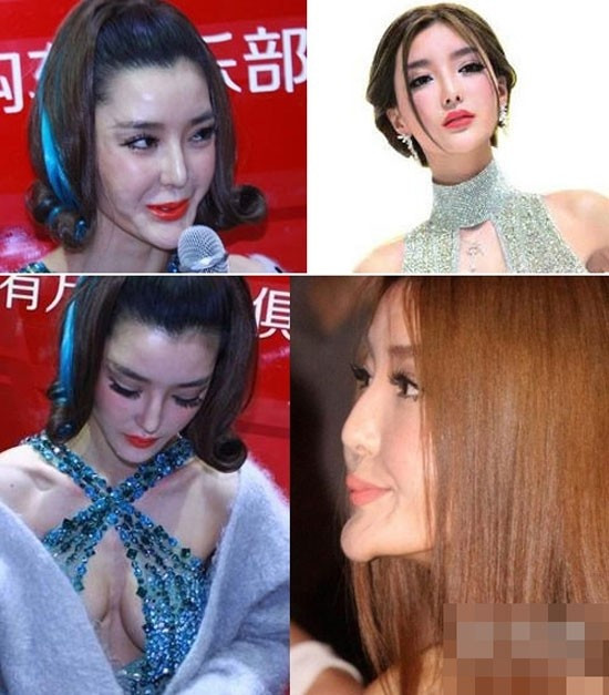 Vì chạy theo mốt cằm nhọn, mắt to, mũi cao mà 'Nữ hoàng đường đua' Lý Dĩnh Chi bị xếp vào hàng thảm họa thẩm mỹ của Cbiz.