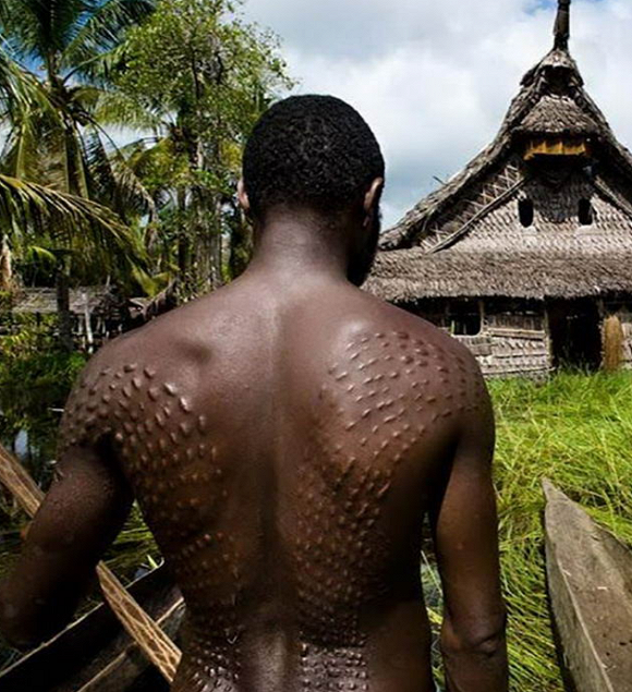7. Nghi lễ trưởng thành - Rạch da như cá sấu Papua New Guinea là một quốc gia nằm ở châu Đại Dương, có đa dân tộc, đặc biệt là nơi có nhiều bộ tộc thổ dân sinh sống. Nơi đây, có một dân tộc vẫn còn tồn tại nghi lễ trưởng thành rất kì dị và vô cùng đau đớn, con trai khi trưởng thành sẽ tham gia nghi thức được những người già trong làng dùng dao rạch những đường nhỏ dọc trên lưng hay cánh tay. Những vết thương này sẽ không được chữa trị cho đến khi nó thành một vết sẹo gồ lên. Người dân ở đây tin rằng khi những chàng trai có được những vết sẹo ấy thì cũng đồng nghĩa với việc họ đã được thay đổi toàn diện, hoàn toàn loại bỏ tính trẻ con ra khỏi người.