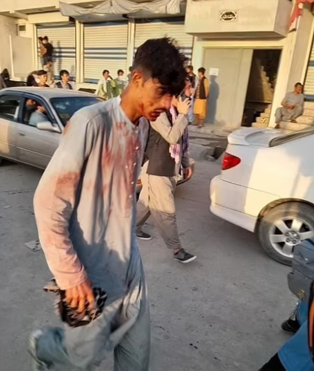 Một người đàn ông bị thương rời khỏi sân bay Kabul. Ảnh: Daily Mail.