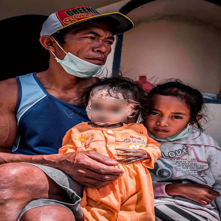 Thi thể của một bé gái được gia đình đưa về nhà trước nghi thức Rambu Solo.
