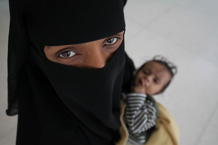 Người mẹ đang bế con tới bệnh viện Al-Sabeen ở thủ đô Sanaa, Yemen.