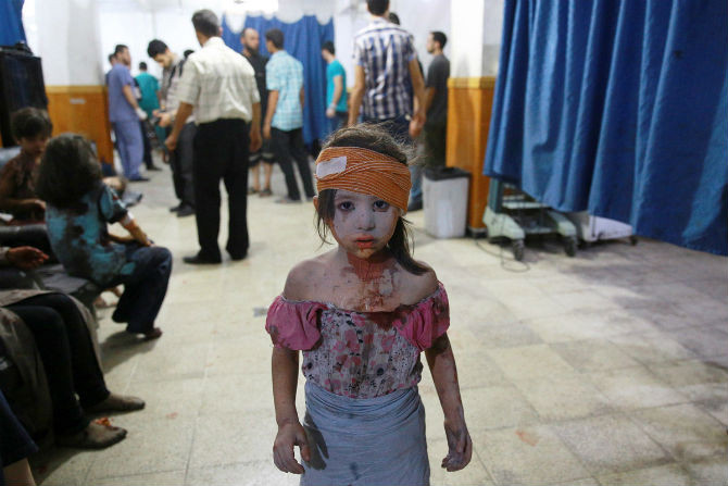 Một bé gái Syria bị thương đứng trong một bệnh viện tạm bợ ở Douma nơi quân nổi dậy kiểm soát. Nét mặt ngây thơ, tội nghiệp của bé gái là một trong những bức ảnh đầy ám ảnh về sự tàn khốc của cuộc chiến tại Syria.