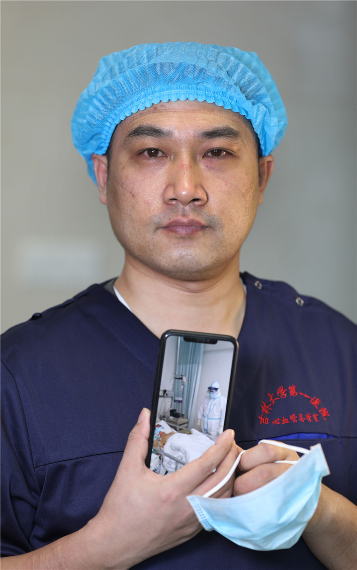 Trên gương mặt của bác sĩ Wang Shudong, đến từ Bệnh viện số 1 Đại học Cát Lâm, vẫn còn những vết hằn do đeo khẩu trang.
