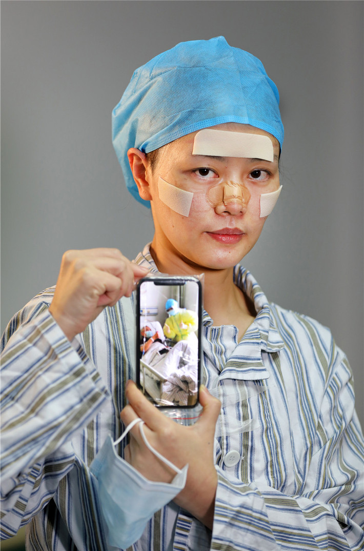 Theo China Daily, bộ ảnh của Li Ge chụp các y bác sĩ - những người hùng tuyến đầu trong cuộc chiến chống Covid-19 ở "tâm dịch" Vũ Hán (Trung Quốc) - khi họ cởi bỏ khẩu trang. Ảnh: Y tá Xu Jian đến từ bệnh viện tỉnh Phúc Kiến. Cô tiết lộ hình ảnh chăm sóc bệnh nhân nhiễm virus corona chủng mới (SARS-CoV-2) được chụp bằng điện thoại. (Nguồn ảnh: China Daily/Reuters)