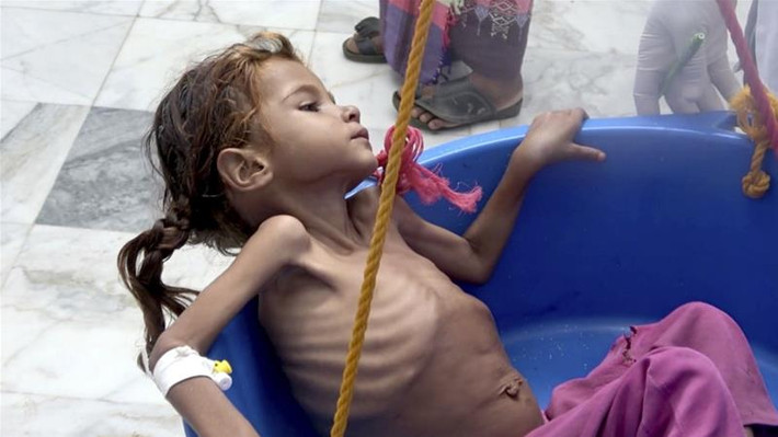 Dự báo, Yemen sẽ là quốc gia đối diện với thảm hoạ nhân đạo tồi tệ nhất trong năm 2019. Liên Hợp Quốc cho biết, khoảng 132 triệu người ở 42 quốc gia trên toàn thế giới sẽ cần cứu trợ nhân đạo và bảo vệ trong năm tới.