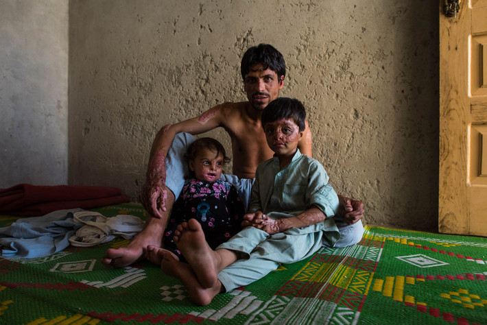 Afghanistan cũng là quốc gia chìm sâu trong xung đột những năm gần đây. Các cuộc giao tranh cùng với tình trạng hạn hán kinh niên đã gây ra tình trạng mất an ninh lương thực và khiến nhiều người dân phải rời bỏ nhà cửa.