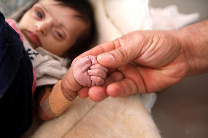 Ước tính, cuộc chiến tại Yemen đã khiến 56.000 người thiệt mạng. Khoảng 8,4 triệu người dân nước này đang đối mặt với nạn đói và con số có thể tăng lên đến 14 triệu.