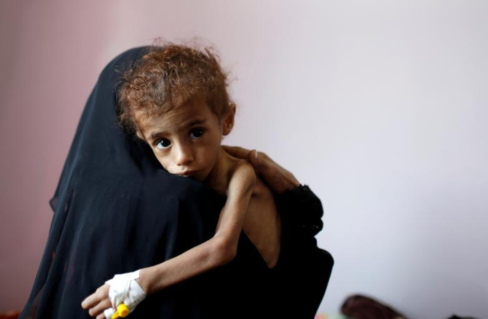 Người phụ nữ bế một bé trai bị suy dinh dưỡng trong bệnh viện al-Sabeen ở Sana, Yemen, ngày 6/10. Các cuộc xung đột tại Yemen những năm qua đã tàn phá nặng nề quốc gia Trung Đông này và gây ra cuộc khủng hoảng nhân đạo trầm trọng.