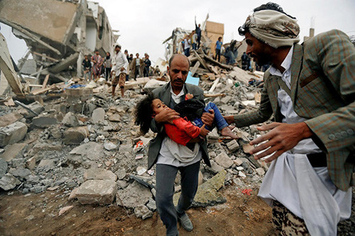 Reuters đưa tin, vụ không kích ở Yemen nhằm vào một tòa nhà ở thủ đô Sanaa xảy ra hôm 25/8. Buthaina Muhammad Mansour, 4 hoặc 5 tuổi, là nạn nhân còn sống duy nhất trong vụ oanh kích ở vốn cướp đi sinh mạng tất cả người thân của Buthaina, trong đó có bố mẹ, 5 anh chị em ruột và người chú có tên Mounir. Ảnh: Reuters.