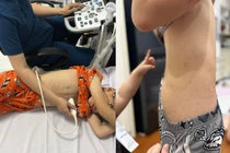 Ồn ào trại hè làng háo hức, dân mạng 9 người 10 ý