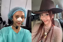 'Em xinh' Quỳnh Anh Shyn khiến fan xôn xao khi tiết lộ phẫu thuật thẩm mỹ