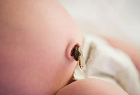 Dấu hiệu bất thường ở trẻ sơ sinh