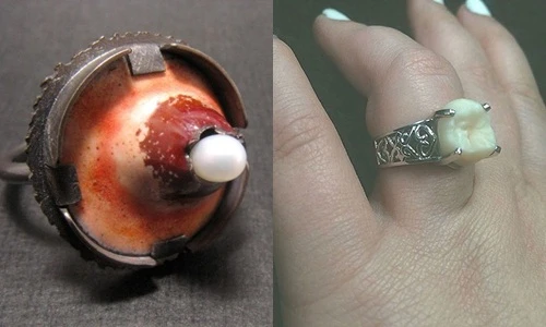 Top những chiếc nhẫn kỳ dị nhất thế giới