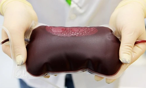 Truyền máu thanh niên, trào lưu hồi xuân độc dị của người Mỹ