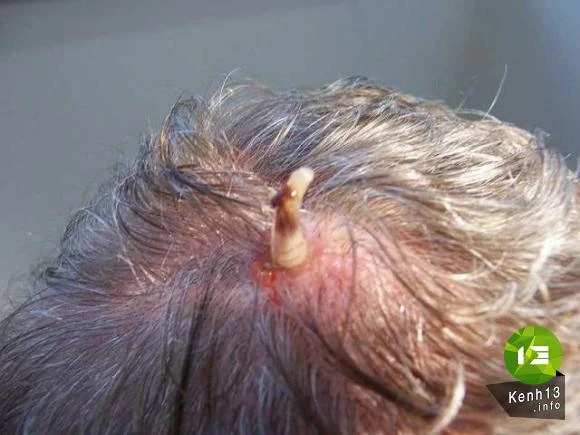 Những hình ảnh khủng khiếp về bệnh tật xưa và nay