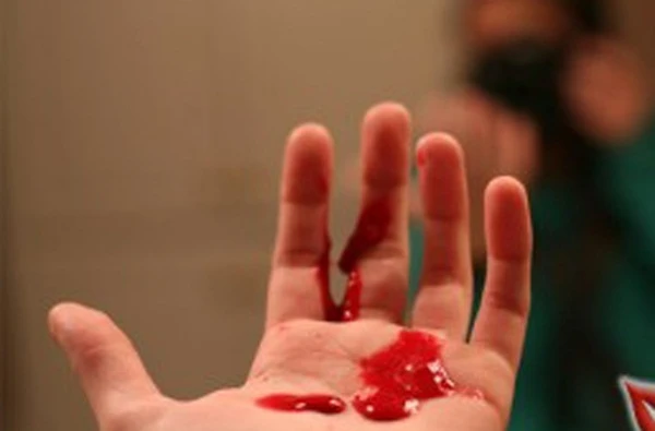 5 bệnh ung thư nhanh chết, khó phát hiện sớm