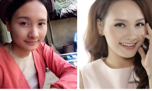 Nhan sắc của Bảo Thanh trước phẫu thuật thẩm mỹ