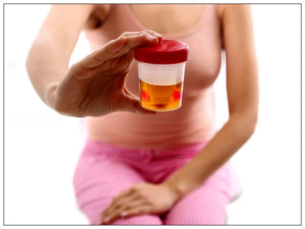 Giải mã lý do bất ngờ khiến bạn tiểu ra máu cục