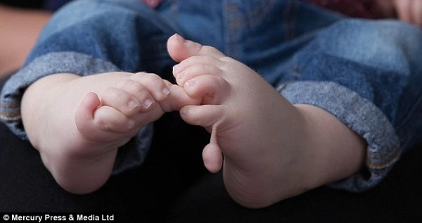 Cậu bé kì lạ có 24 ngón tay, ngón chân dị thường