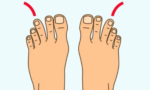 Hình dáng bàn chân tiết lộ điều gì về bạn?