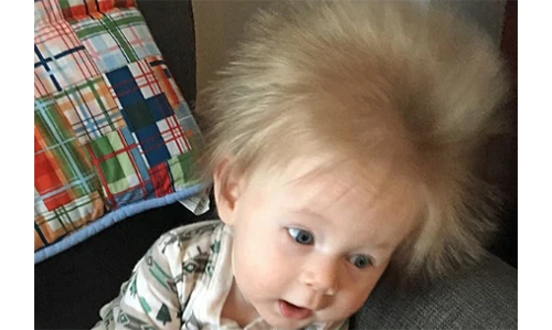 Cậu bé có mái tóc dài kỳ lạ ngay từ khi còn trong bụng mẹ