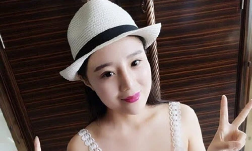 Gái xinh hói đầu vì ăn ngô bằng máy khoan giờ ra sao?