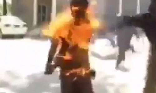 Kinh hãi điện thoại bốc cháy trong túi quần, thiêu chủ nhân