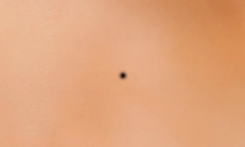 6 nốt ruồi mang lại phúc lộc cả đời cho chủ nhân