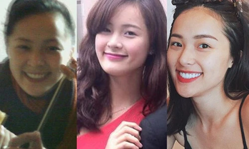 Mỹ nhân Việt: Ai dám nhận... “người đẹp dao kéo“?