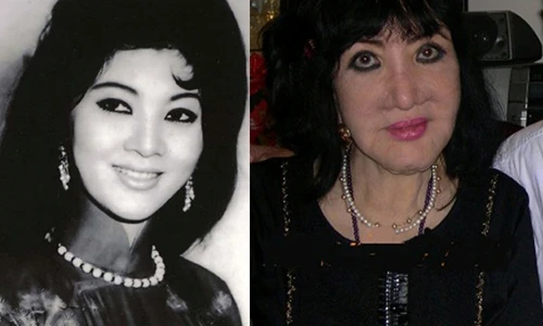 Những ca phẫu thuật thẩm mỹ kinh hoàng nhất trong lịch sử